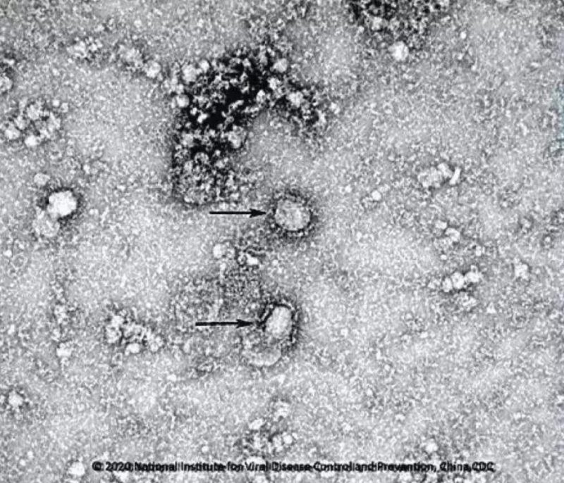 ▲新型冠狀病毒武漢株01。照片來源：國(guó)家病原微生物資源庫(kù)（中國(guó)疾病預(yù)防控制中心病毒病預(yù)防控制所）